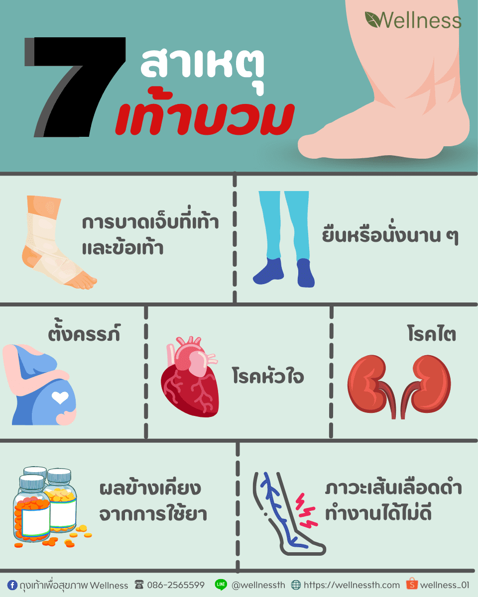 7 สาเหตุ ที่ทำให้เท้าบวม