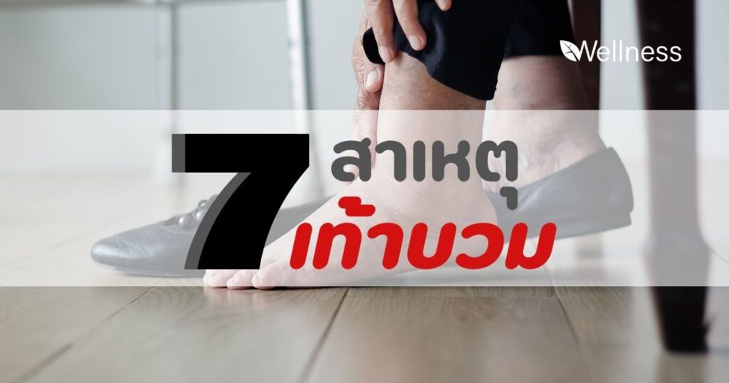 7 สาเหตุเท้าบวม